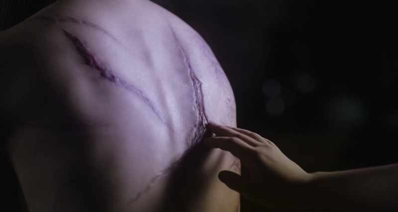 The next day, she cut herrself with a knife