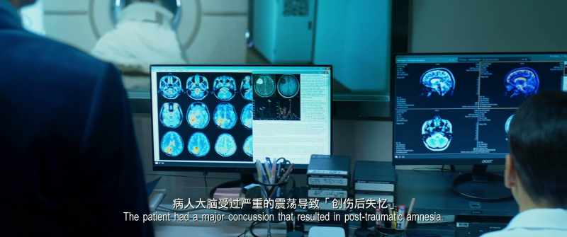 The patient had a major concussion