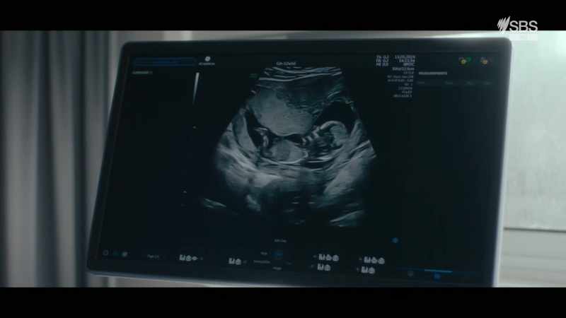 The placenta and umbilical cord are well placed