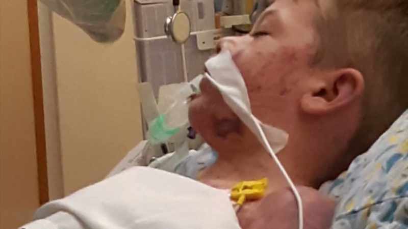 The psychologist talked to him. The surgeons talked to him