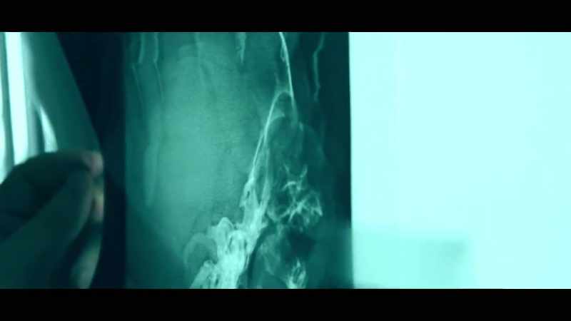 The radiographs immediately showed that there was