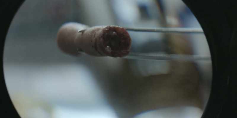 The severed body part