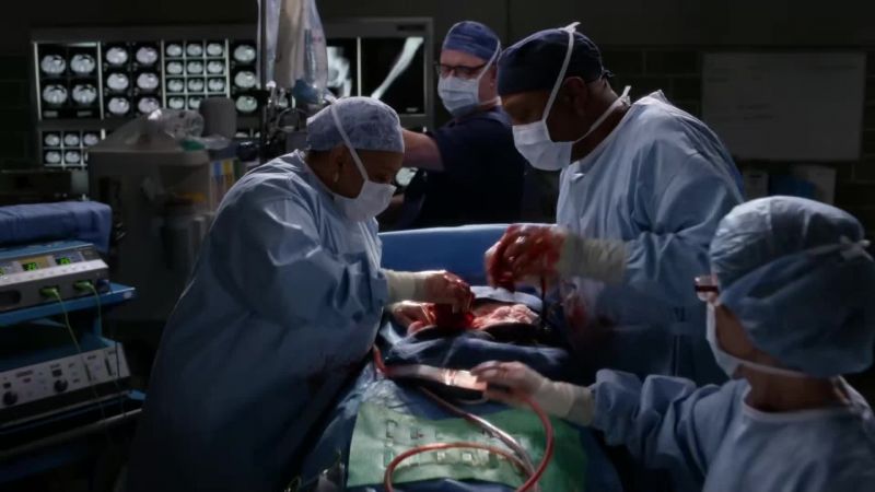 The subcostal incision isn't enough