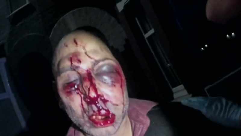 The swelling, with his eyes like that
