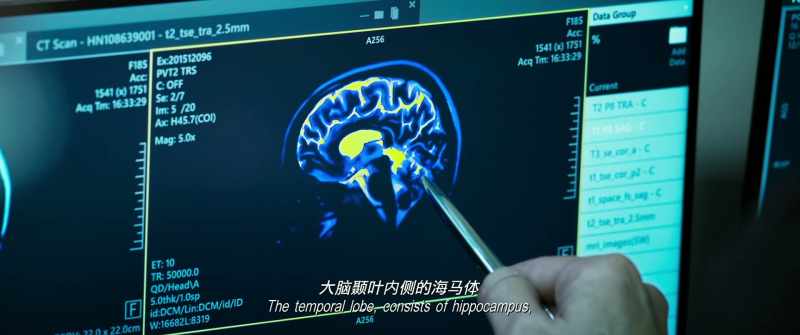 The temporal lobe consists of hippocampus