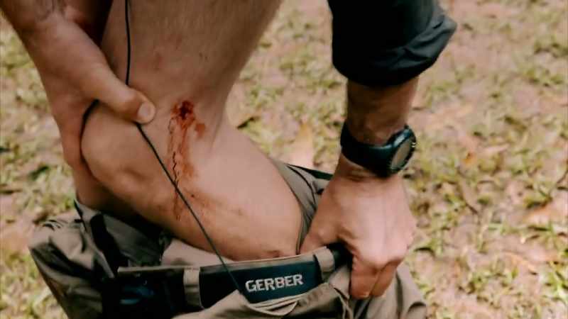 THE THING ABOUT LEECHES IS THAT WHEN THEY BITE YOU
