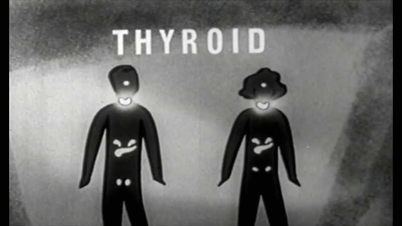 The thyroid hormone that comes from the thyroid