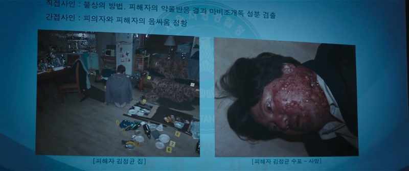The victim's autopsy showed