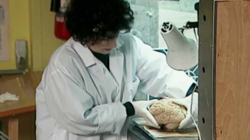 The width of the brain, from left to right