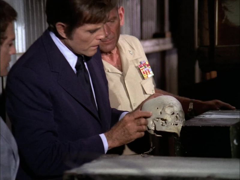 THEN HOW COME HE'S GOT A BULLET HOLE IN HIS HEAD?