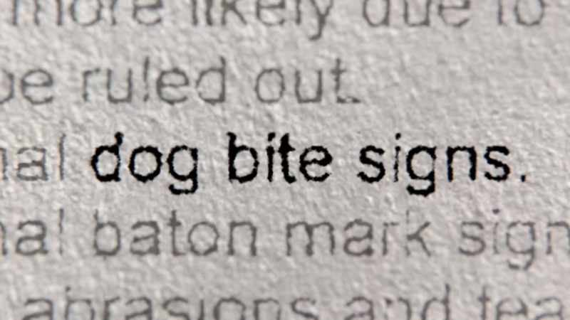 There are several areas consistent with dog bites