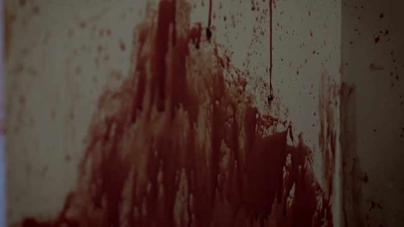 There was blood everywhere