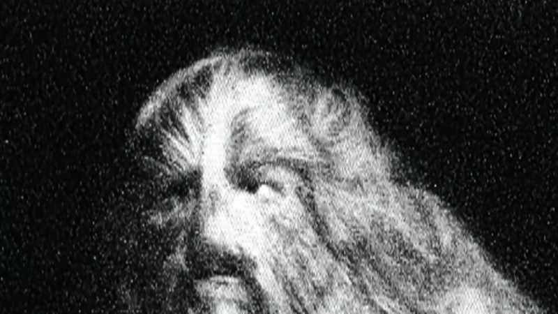 THERE IS A GENETIC CONDITION KNOWN AS HYPERTRICHOSIS