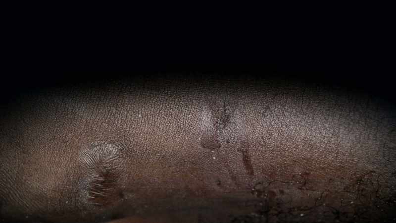 There were ligature marks around his ankles