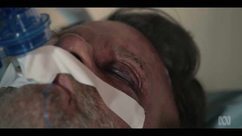 There was no brain bleed detected on the scan