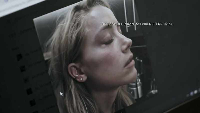 There were photographs of her injuries