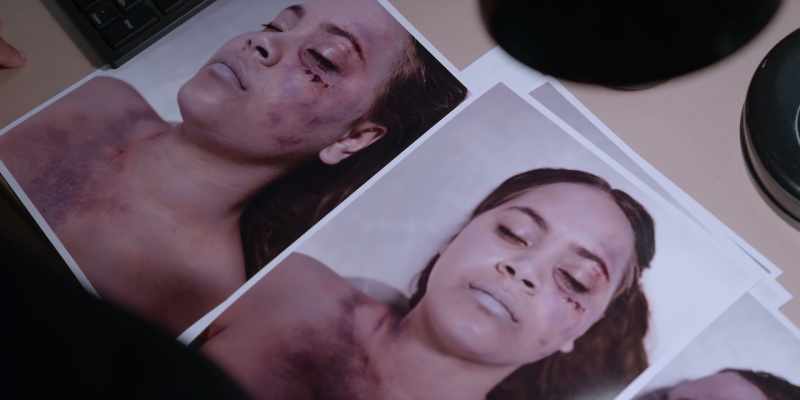 There's bruising so she was still alive when she was hit