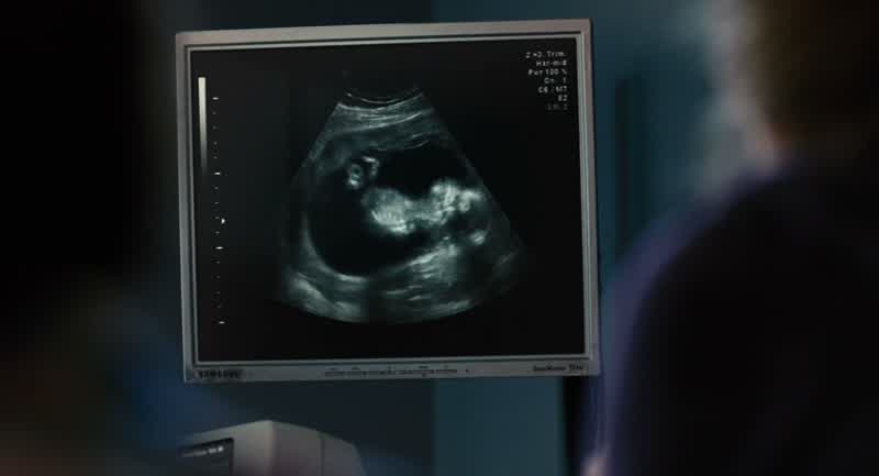 There's your baby