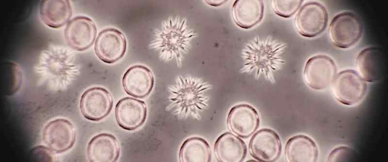 These cells aren't dead