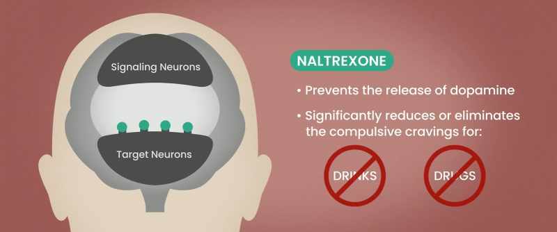 These implants block the opiate receptors in the brain