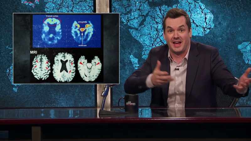 THEY JUST ASSUMED HE HAD BRAIN