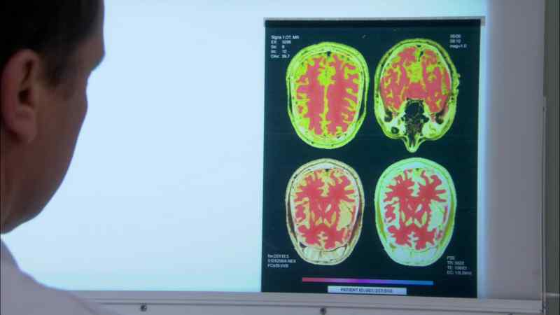 They said the MRI machine was broken