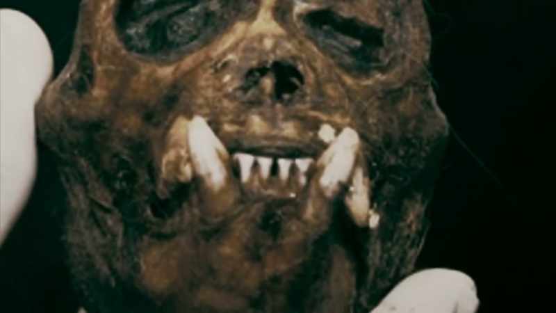 THEY TURNED OUT TO BE JUST ITS NORMAL TEETH