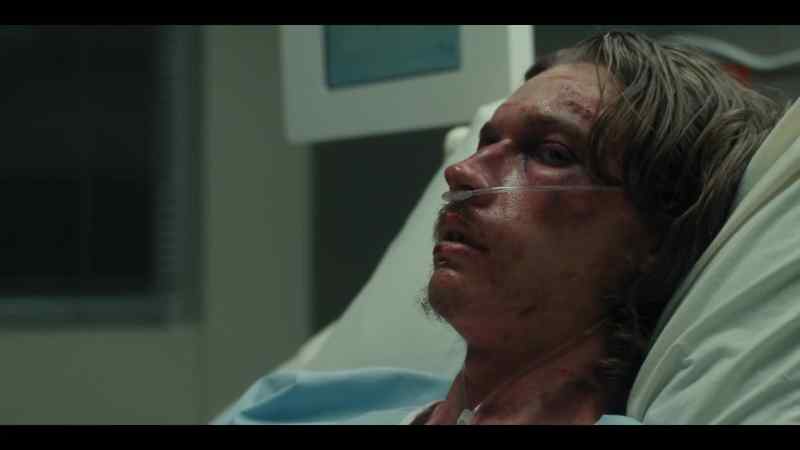 This ain't the first time you took a beating over this girl