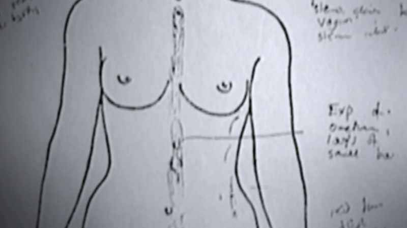 This body was not only strangled