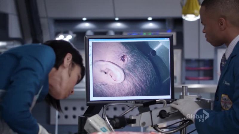This injury's definitely antemortem