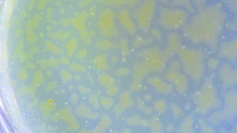 This microbiome is a living, breathing organism…