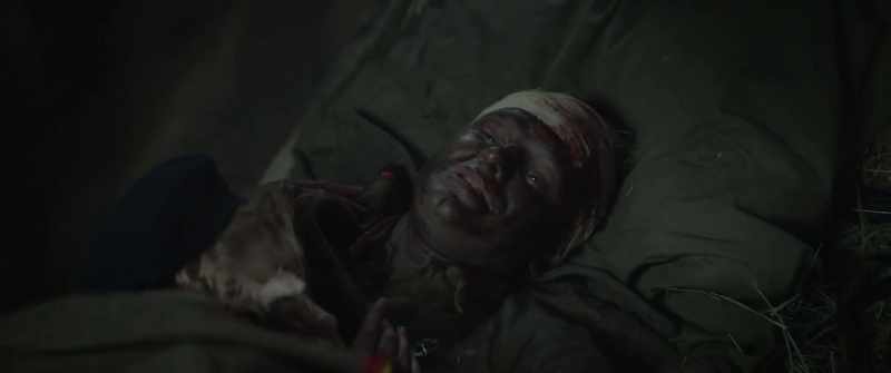 This is nothing, just a flesh wound