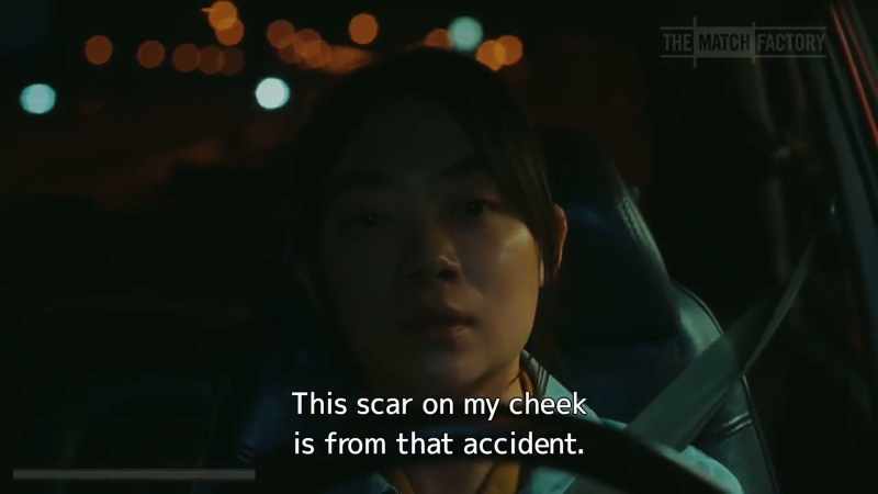 This scar on my cheek is from that accident