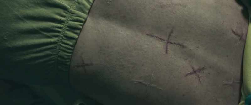 This series of scars