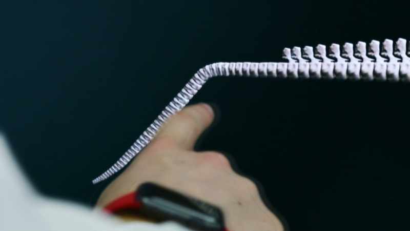 This is supported by the backbone
