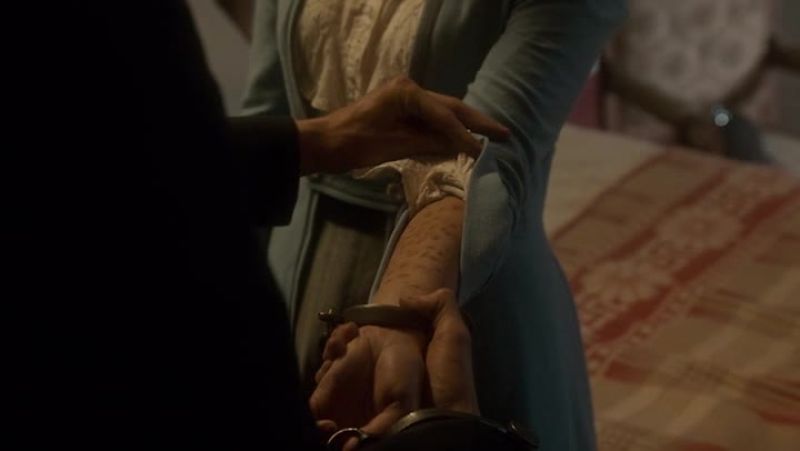 This is where she burned you with cigarettes