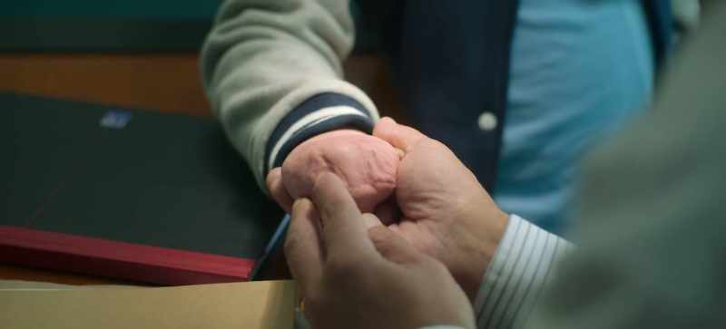 This is where we could attempt the other skin graft. Just here, see?