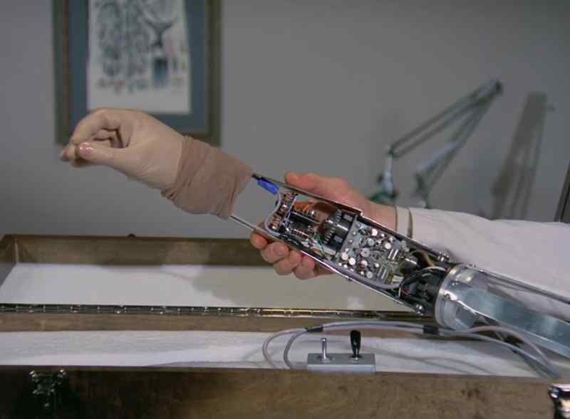 This is your arm, Steve