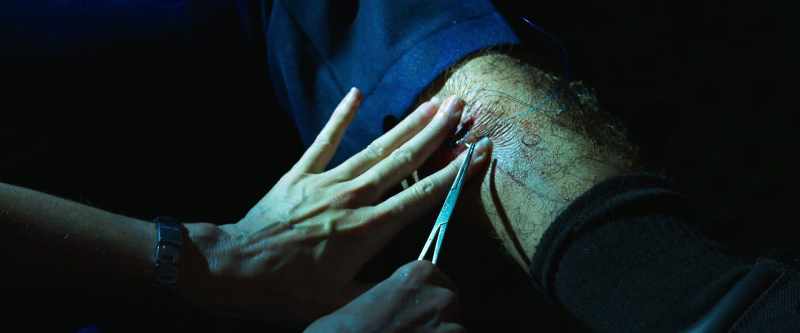 Tibia, fibula clear