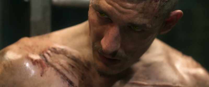 To rip someone's teeth out. You're talking about the burn?