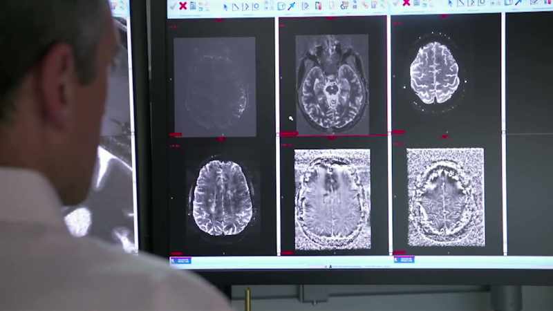 Today, a diagnosis of multiple sclerosis is very different