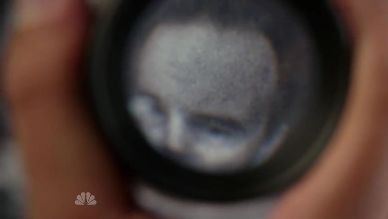 Tom: Karakurt had extensive facial surgery