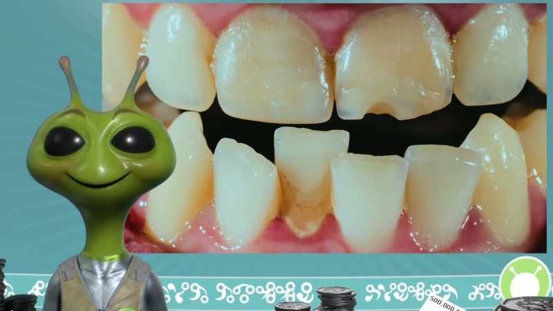 Tonight's story: human teeth