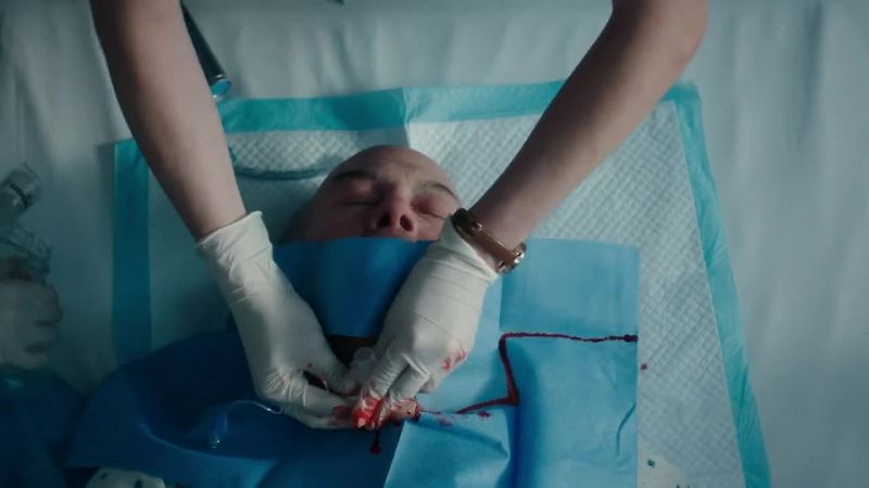 Trach tube