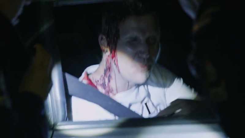 Two police cops bit me at that checkpoint. How are you feeling, sir?