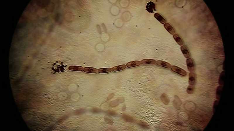 Typhus, anthrax, tuberculosis