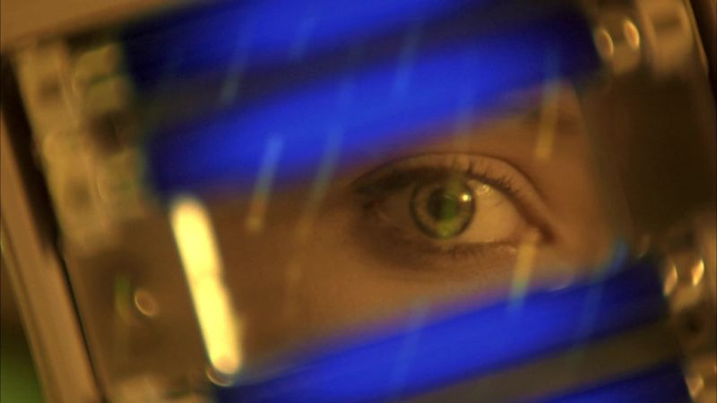 Ulcerative keratitis