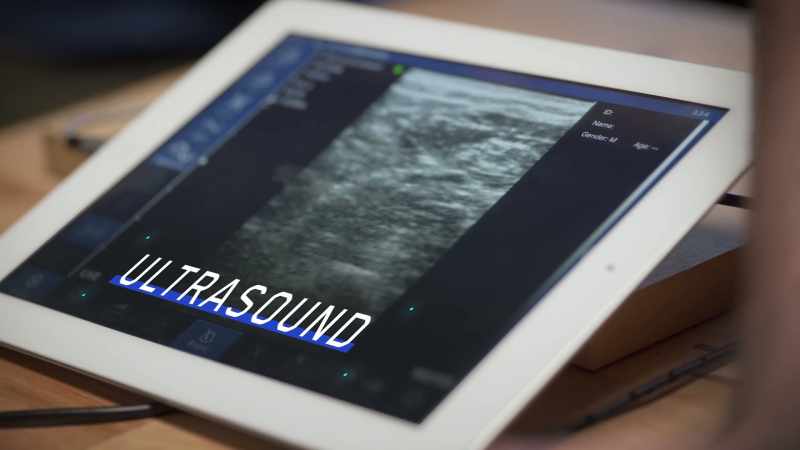 Ultrasound provides an image
