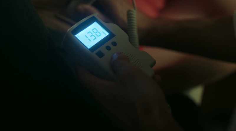 (ultrasound whirring)