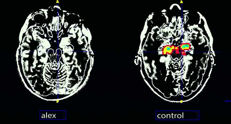 Um, do you think my amygdala actually just doesn't work or something?